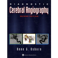 脑血管造影诊断Diagnostic Cerebral Angiography