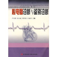 心电图诊断与鉴别诊断