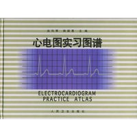 心电图实习图谱