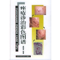 痤疮诊治彩色图谱
