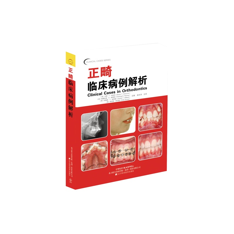《正畸临床病例解析(口腔临床病例解析丛书)》