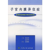 子宫内膜异位症