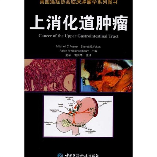 【上消化道肿瘤(美国癌症协会临床肿瘤学系列