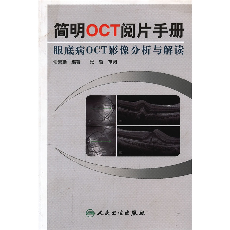 简明oct阅片手册