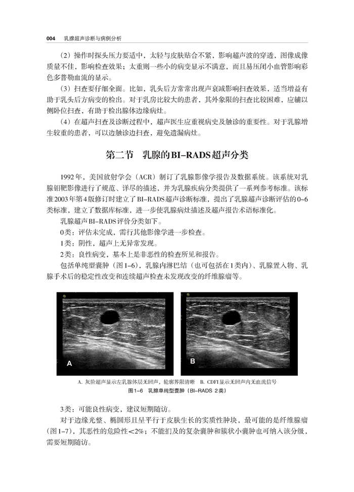 8例男性乳腺癌超声特点诊治论文